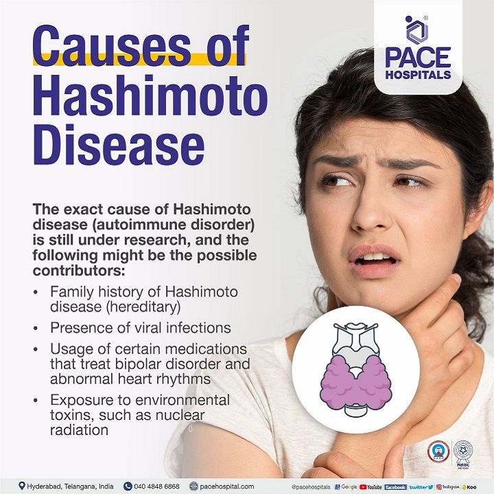 Hashimoto S Thyroiditis Hashimotos Disease Symptoms Causes